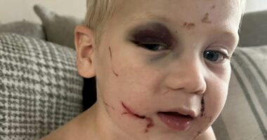 Fury as daycare worker who 'battered one-year-old boy' is released