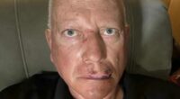 Horrific injuries suffered by grandpa, 66, beaten up by child