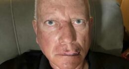 Horrific injuries suffered by grandpa, 66, beaten up by child