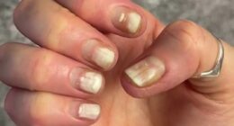 Horrifying risks of gel manicures revealed - from allergies to cancer