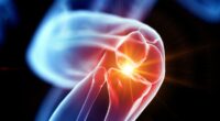 How you can ease the agony of knee pain - and even avoid surgery - with these six simple steps that medical experts say really work