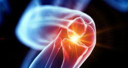 How you can ease the agony of knee pain - and even avoid surgery - with these six simple steps that medical experts say really work