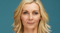 I was 52 with a 'turkey neck', here's how I turned back the clock