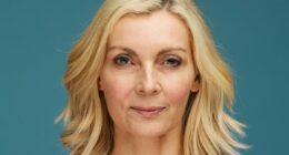 I was 52 with a 'turkey neck', here's how I turned back the clock