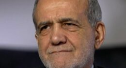 Iranian pres. details his injuries in Israeli bombing