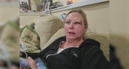 Mom of 11 recovering after alleged serial puncher attack