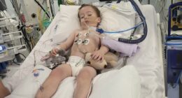 My baby had a stroke when he was two years old - here's the simple treatment I wish I'd know about that could have prevented it