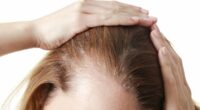 New study confirms link between fat jabs and hair loss, after thousands of users complained of shedding and bald patches