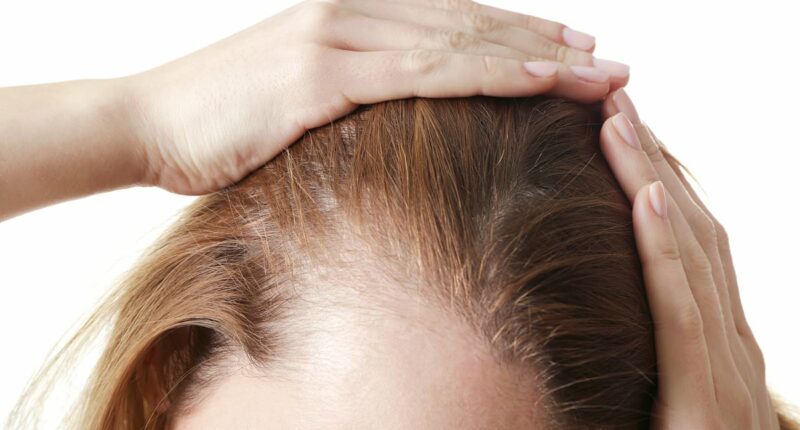 New study confirms link between fat jabs and hair loss, after thousands of users complained of shedding and bald patches