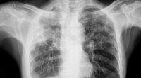 Panic spreads as Maine residents are infected with world's deadliest disease