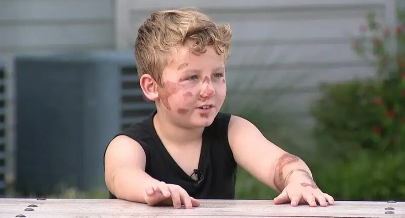 SUV driver runs over 8-year-old boy on bike, flees the scene after checking on injured child