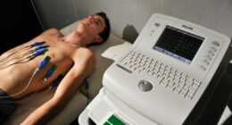 Star athlete was a heartbeat from death when screening spotted hidden syndrome