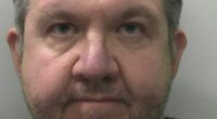 Surgeon ADMITS having legs removed then lying about sepsis for payout