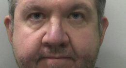 Surgeon ADMITS having legs removed then lying about sepsis for payout