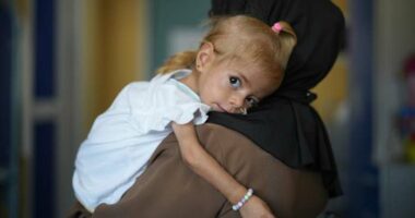 Toddler evacuated from Gaza with rare disease recovers from malnutrition in Italian hospital