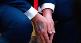 Trump, who questioned his opponents' health, rebuffs rumors about his own
