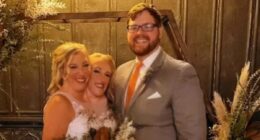 When conjoined twins decided to have a baby, there were complications