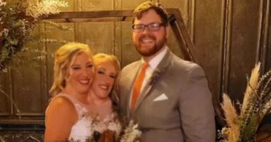 When conjoined twins decided to have a baby, there were complications