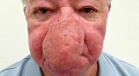 'I couldn't kiss my wife because my nose just kept growing'
