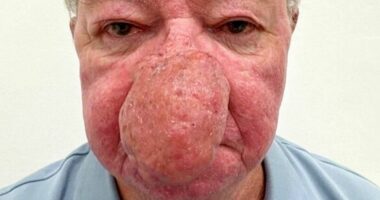 'I couldn't kiss my wife because my nose just kept growing'