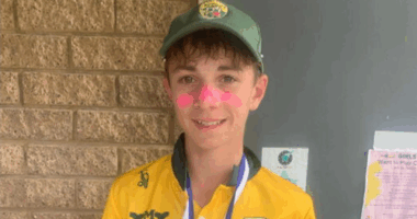 A teenage cricketer who was injured in a training accident in Melbourne on Tuesday has died, his club has revealed. Ben Austin, 17, was batting in the nets when he was hit in the head and neck area by a ball.
