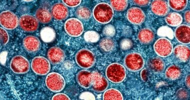 1st in-country transmission of new mpox strain confirmed in US