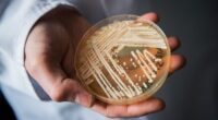 7 risk factors of deadly fungus infections identified, new Candida auris research finds