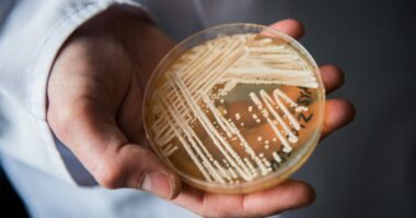 7 risk factors of deadly fungus infections identified, new Candida auris research finds