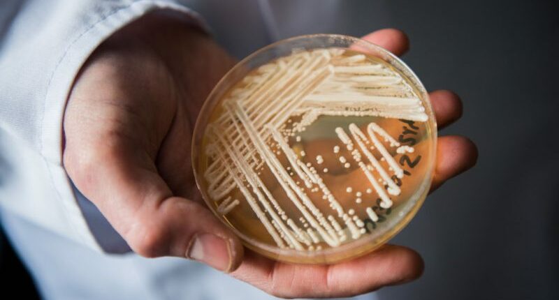 7 risk factors of deadly fungus infections identified, new Candida auris research finds