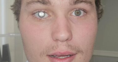 'Bond Villain' jeweller has DIAMOND embedded into his artificial eye