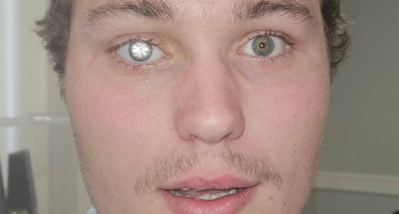 'Bond Villain' jeweller has DIAMOND embedded into his artificial eye