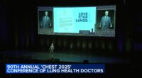 Chicago Mayor Brandon Johnson declares Oct. 19 'Love Your Lungs Day' as doctors gather at McCormick Place for CHEST conference