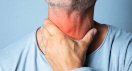 Covid variants Nimbus and Stratus are soaring - with unusual symptoms