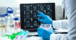 Dementia diagnosis breakthrough as researchers 'hugely encouraged'