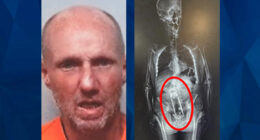 Florida Man Found With Large Thermos up Rectum After 26th Arrest