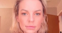 General Hospital star Kirsten Storms to undergo brain surgery