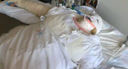 Harrowing 64 seconds of horror for innocent woman, 20, set on FIRE