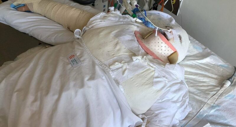 Harrowing 64 seconds of horror for innocent woman, 20, set on FIRE