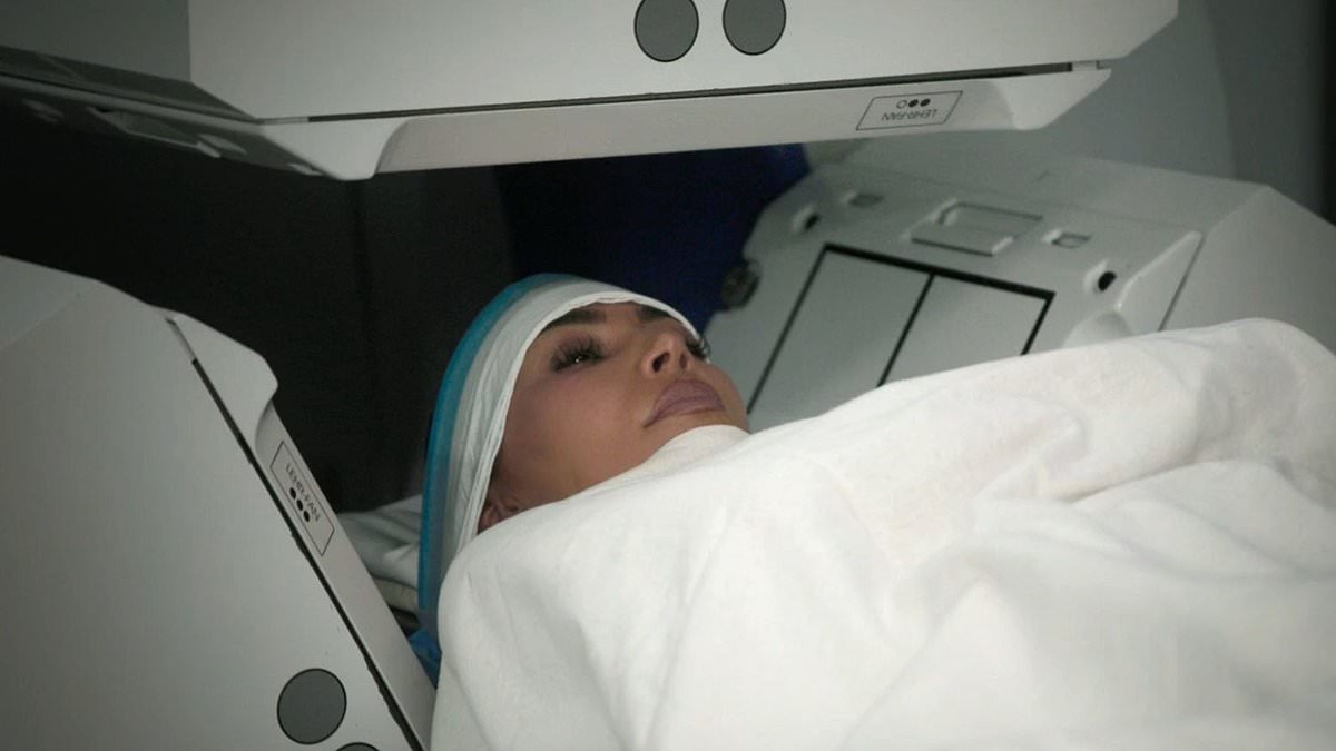 Subtle Indicators of a Brain Aneurysm: Insights Following Kim Kardashian’s Recent Diagnosis
