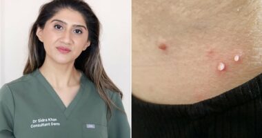 How to get rid of unsightly skintags: They start as flat bumps then grow to hang from the body. Now doctors reveal what really works to banish them - and when they could be a sign of cancer or diabetes