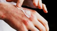 How to soothe dry, sore hands - skin specialists share the simple tricks that really work