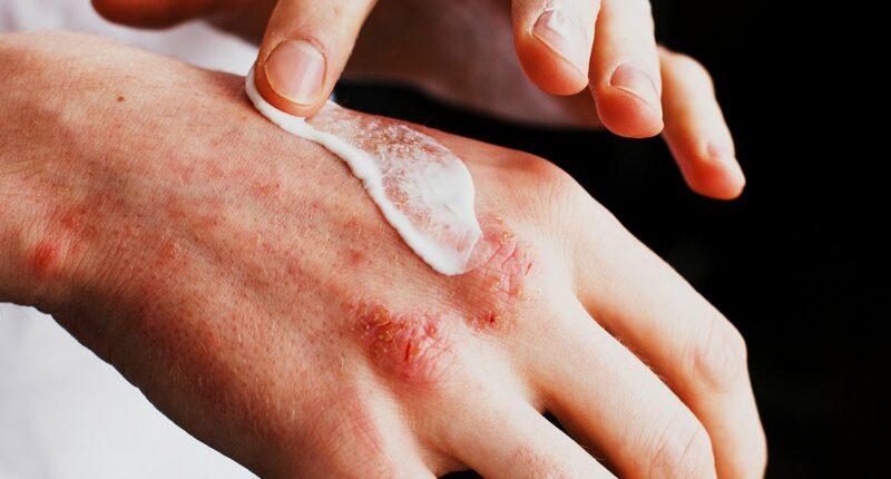 How to soothe dry, sore hands - skin specialists share the simple tricks that really work