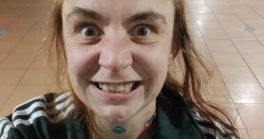 Innocent victim of random street stabbing breaks her silence