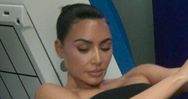 Kim Kardashian, 45, reveals doctors found brain aneurysm after MRI