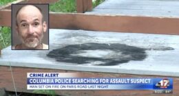 Man set on fire on porch, 80% of skin burned in fatal attack