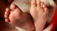 Mom Steamed Infant Daughter’s Face Until Her Skin Peeled Off Because She Wasn’t a Boy