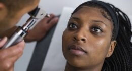 NHS issue warning over common eye condition and how to get free eye test