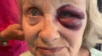 Pensioner, 68, 'lucky' to be alive after accident before dad's funeral