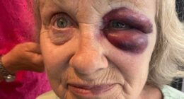 Pensioner, 68, 'lucky' to be alive after accident before dad's funeral