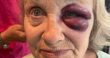 Pensioner, 68, 'lucky' to be alive after accident before dad's funeral